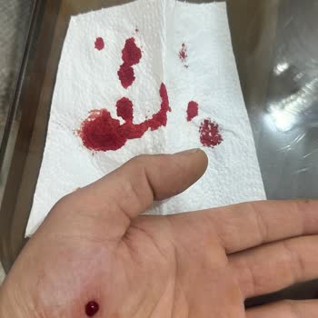 ECA Kombideki Metal Etiket Derin Kesik Verdi, Güvenlik Sorunu