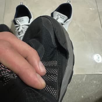 Skechers Ayakkabısının 2,5 Ayda Dikiş Sorunu Ve Kullanıcı Hatası Reddi