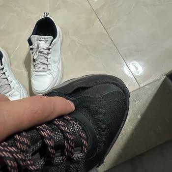 Skechers Ayakkabısının 2,5 Ayda Dikiş Sorunu Ve Kullanıcı Hatası Reddi