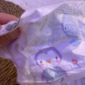 Molfix Bebek Bezinde Yabancı Madde Keşfi Sağlık Riski Ve Müşteri Hizmetlerine Ulaşılamama