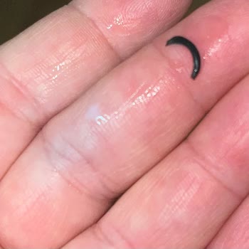 Sek Sütünde Metal Parça Bulundu, Güvenim Sarsıldı