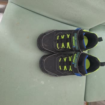 Çocuğumun Ayağını Tahriş Eden Skechers Ayakkabı İçin Değişim Talebi