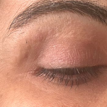 Op. Dr. Bilgen Katipoğlu Erenoğlu İşlemin Sonucundan Son Derece Memnuniyetsizim