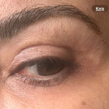 Op. Dr. Bilgen Katipoğlu Erenoğlu İşlemin Sonucundan Son Derece Memnuniyetsizim