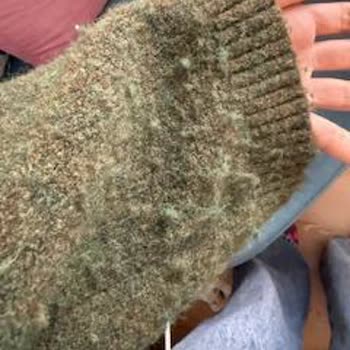 Koton Kazakta Tüylenme Sorunu Ve Çözüm Bulunamaması