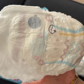 Şok Marketten Alınan Molfix Bezinin Sahte Olduğu Şüphesi Ve Bebekte Şiddetli Pişik