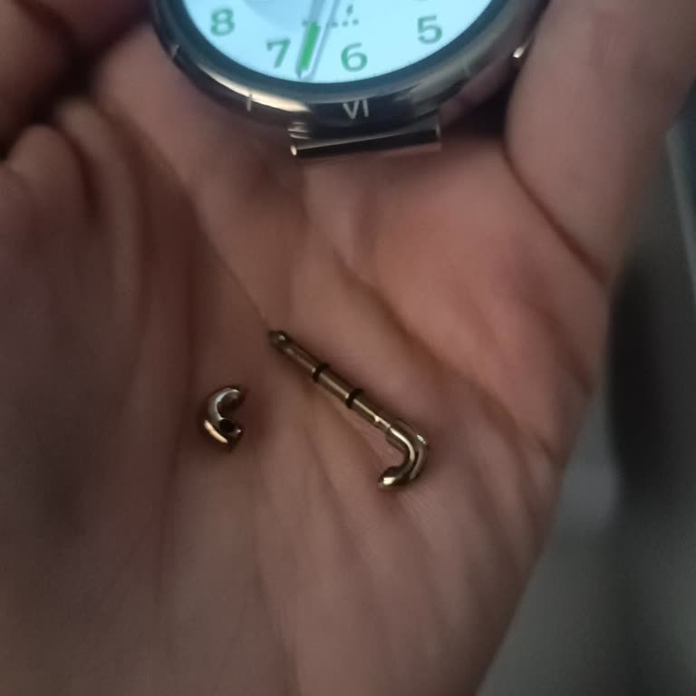 Huawei Akıllı Saat Kordon Sorunu, Aşırı Servis Ücreti Ve Eksik Parça İadesi