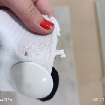 Alarmı Unutulmuş Ve Yırtık Çoraplar İçin İade Talebi