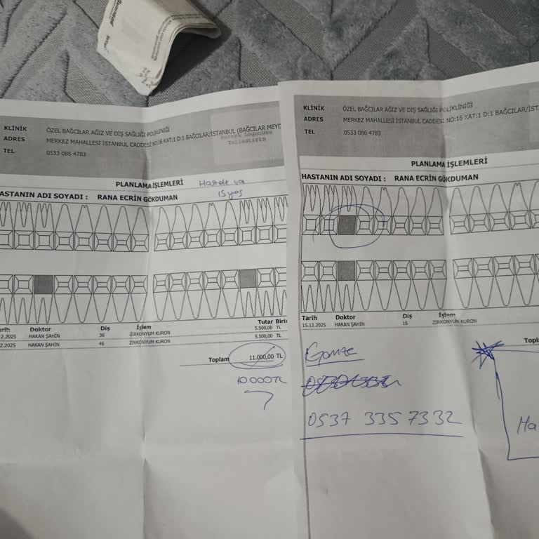 Yanlış Diş Hazırlığı Ve Kaplamaların Ertesi Gün Düşmesi Nedeniyle 13.000 TL Ücret Ve Ağrı Şikayeti