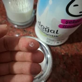 Kefirde Cam Parçası Bulunması Hayati Tehlike Oluşturdu