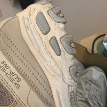 Ayakkabıda Kısa Sürede Yırtılma Ve Çatlak, İnceleme Sonucu Haksız Ret Ve Yağ Lekesi