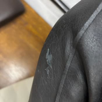 Zara'da 12 Gün İçinde Deri Cekette Kol Soyulması Ve Görünüm Bozulması