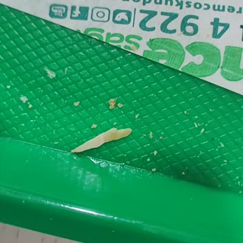 Çocuğumun Boğazına Takılan Plastik Parça Ve Şubenin Umursamazlığı