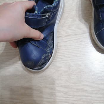 Vicco Çocuk Ayakkabısında Taban Ayrılması, Koku Ve Kalite Sorunu