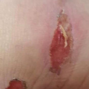 Harley Davidson Botu Ayakları Tahriş Etti, Tam İade Talebi