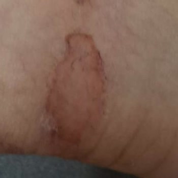 Harley Davidson Botu Ayakları Tahriş Etti, Tam İade Talebi