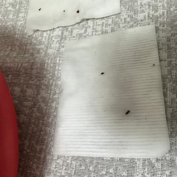 Bebek Temizleme Pamuklarında Siyah Lekeler: Hijyen Endişesi Ve İade Talebi