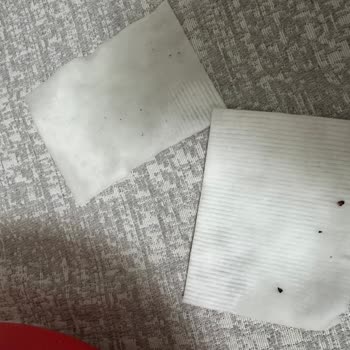 Bebek Temizleme Pamuklarında Siyah Lekeler: Hijyen Endişesi Ve İade Talebi