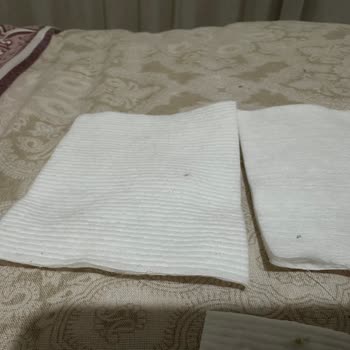 Bebek Temizleme Pamuklarında Siyah Lekeler: Hijyen Endişesi Ve İade Talebi