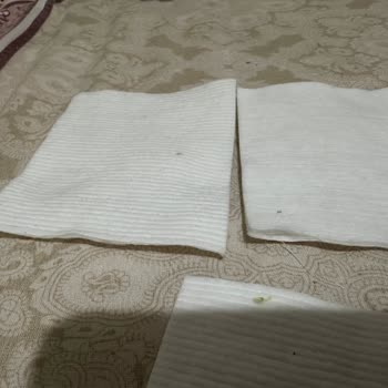 Bebek Temizleme Pamuklarında Siyah Lekeler: Hijyen Endişesi Ve İade Talebi