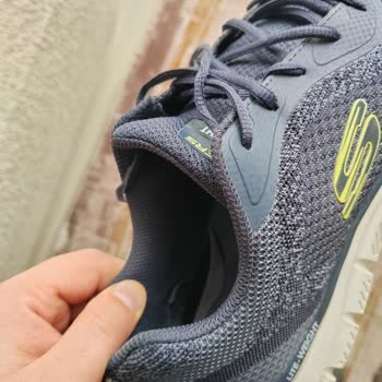Kısa Sürede Yıpranan Skechers Ayakkabıya Olumsuz Ve Hızlı İnceleme Yanıtı