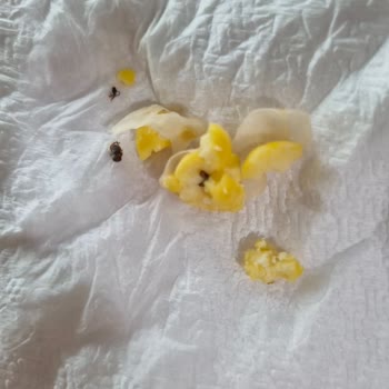 Organik Nohutta Böcek Çıkması Hijyen Endişesi Ve Para İadesi Talebi