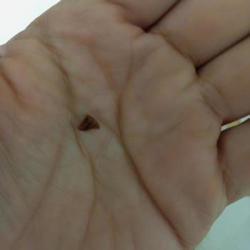 Nimet Kavala Kurabiyesinde Badem Kabuğu Parçası Çıktı, Çocuğumun Dişi Neredeyse Kırıldı