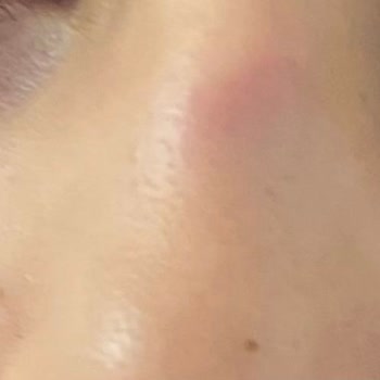 Doğa Koleji Eğitim Kurumları Ciddi Fiziksel Ve Psikolojik Saldırılara Karşı Yetersiz Önlem