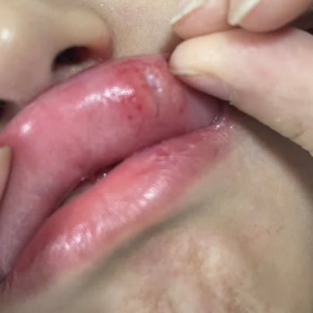 Doğa Koleji Eğitim Kurumları Ciddi Fiziksel Ve Psikolojik Saldırılara Karşı Yetersiz Önlem