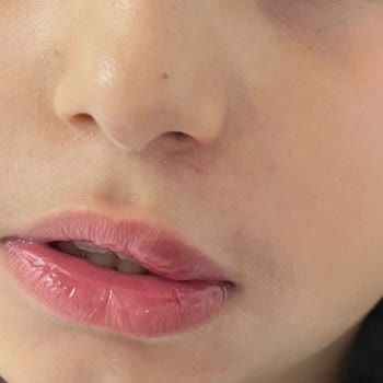 Doğa Koleji Eğitim Kurumları Ciddi Fiziksel Ve Psikolojik Saldırılara Karşı Yetersiz Önlem