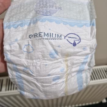 Molfix Premium 3 Numaralı Bezde Lastik Bariyer Eksikliği Ve Sızıntı Sorunu