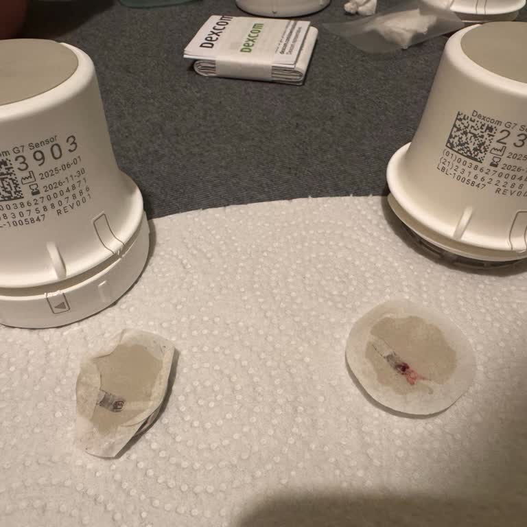 İki Defa Dexcom G7 Sensöründe İğne Ucu Yamukluğu Ve Ücretsiz Değişim Talebi