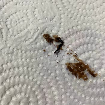 Denizli Pamukkale'de Torku Çikolatasında Yabancı Madde Ve Sağlık Riski