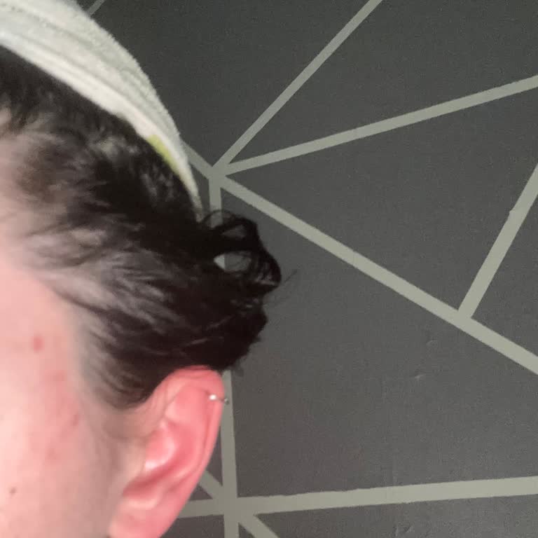 Sebamed Şampuanı Kullanırken Şiddetli Yanma Ve Kızarıklık Yaşadım, Ücret İadesi Talebim