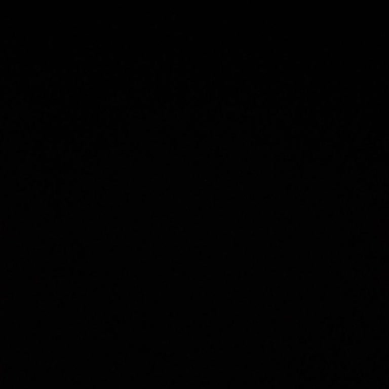 Acil Çözüm Gerektiren Araç Alım Gecikmesi Ve Kapora Sorunu