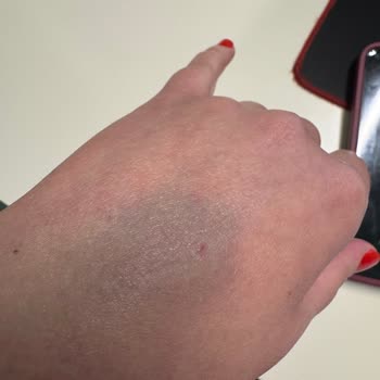 Acilde Tekrarlanan Damar Yolu Açma Başarısızlıkları Ve Saygısız Hemşire Tutumu