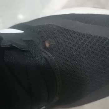 In Street Adidas Ayakkabı Deformasyonu Ve Kullanıcı Hatası İddiasına Karşı İade Talebi Ve Hak İhlali