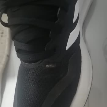 In Street Adidas Ayakkabı Deformasyonu Ve Kullanıcı Hatası İddiasına Karşı İade Talebi Ve Hak İhlali