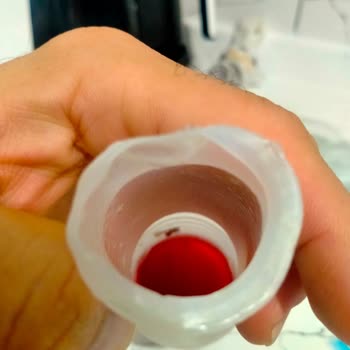 Ülker Şikayetime Kayıtsız Yanıt, Çocuğum İçtiği İçecekteki Siyah Maddeler Nedeniyle Hastalandı