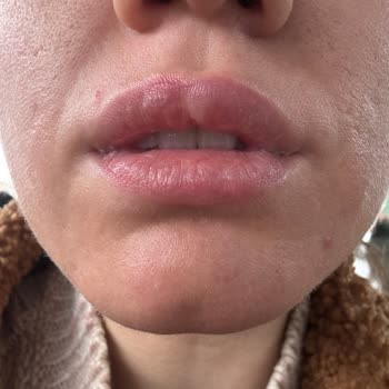 Kalıcı Makyajda Asimetrik Kaş Ve Renk Almayan Dudak, Profesyonellik Eksikliği