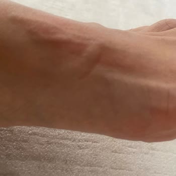 Derimod Botta Ayıplı Ürün Ve Sağlık Sorunu, İade Reddi Ve Fatura Gönderilmemesi