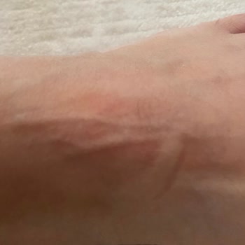 Derimod Botta Ayıplı Ürün Ve Sağlık Sorunu, İade Reddi Ve Fatura Gönderilmemesi