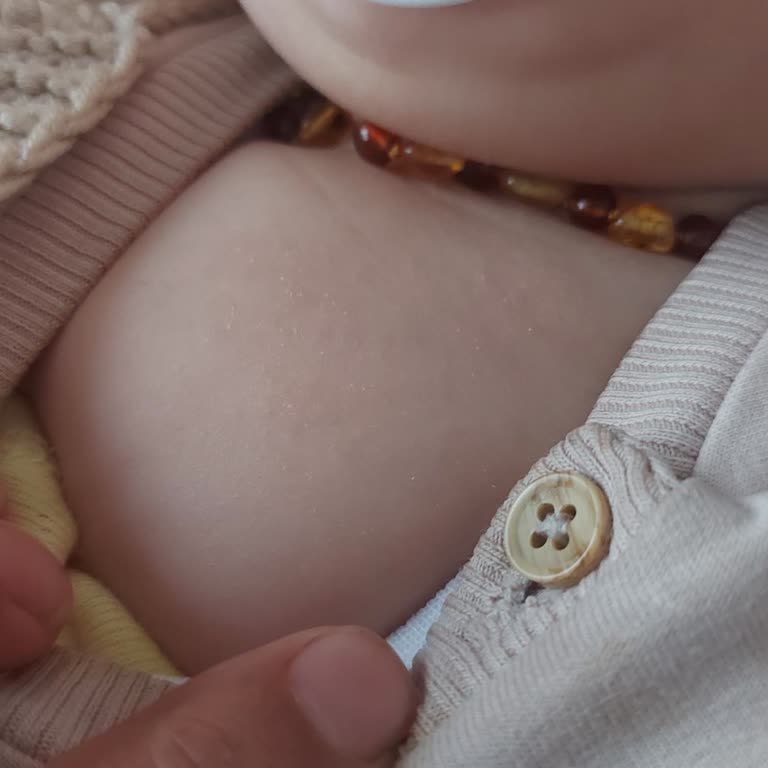 Mustela Şampuanı Ve Kremi Bebek Egzaması İçin Etkisiz, İade Talebi