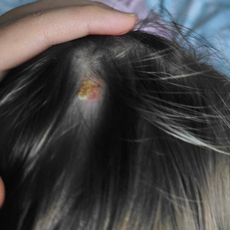 Dalin Bebek Şampuanı Kafa Derisinde Ağır Yara Ve Güven İhlali