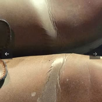 Skechers Ayakkabısının Kısa Sürede Çatlaması Ve Su Alması