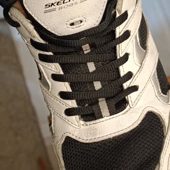 Skechers Ayakkabısında Kısa Sürede Açılan Kumaş Ve Kullanıcı Hatası İddiası