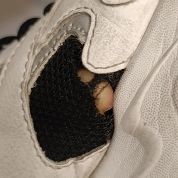 Skechers Ayakkabısında Kısa Sürede Açılan Kumaş Ve Kullanıcı Hatası İddiası