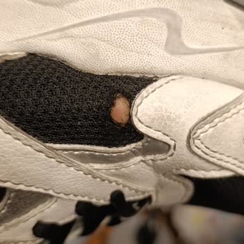 Skechers Ayakkabısında Kısa Sürede Açılan Kumaş Ve Kullanıcı Hatası İddiası