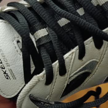 Skechers Ayakkabısında Kısa Sürede Açılan Kumaş Ve Kullanıcı Hatası İddiası