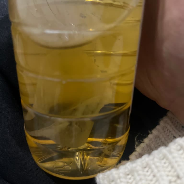 BİM Şubesinden Alınan 750ml Fıçı Elma Sirkesinde Beyaz Tabaka Ve Hijyen Endişesi